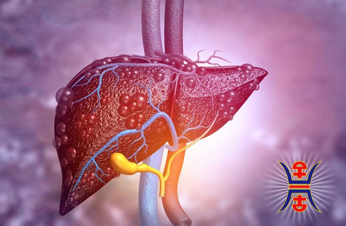 liver-cirrhosis